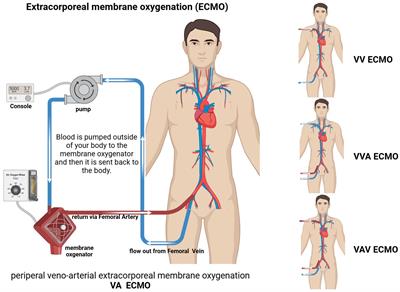 Neutrophils: a key component in ECMO-related acute organ injury